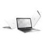 Refurbished DELL Inspiron 15-5000 Series AMD A6-9200 8GB 1TB DVD-RW 15.6 Inch Windows 10 Laptop
