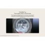 LG WashTower 12kg Wash 10kg Dry 1400rpm Stacked Washer Dryer - Black